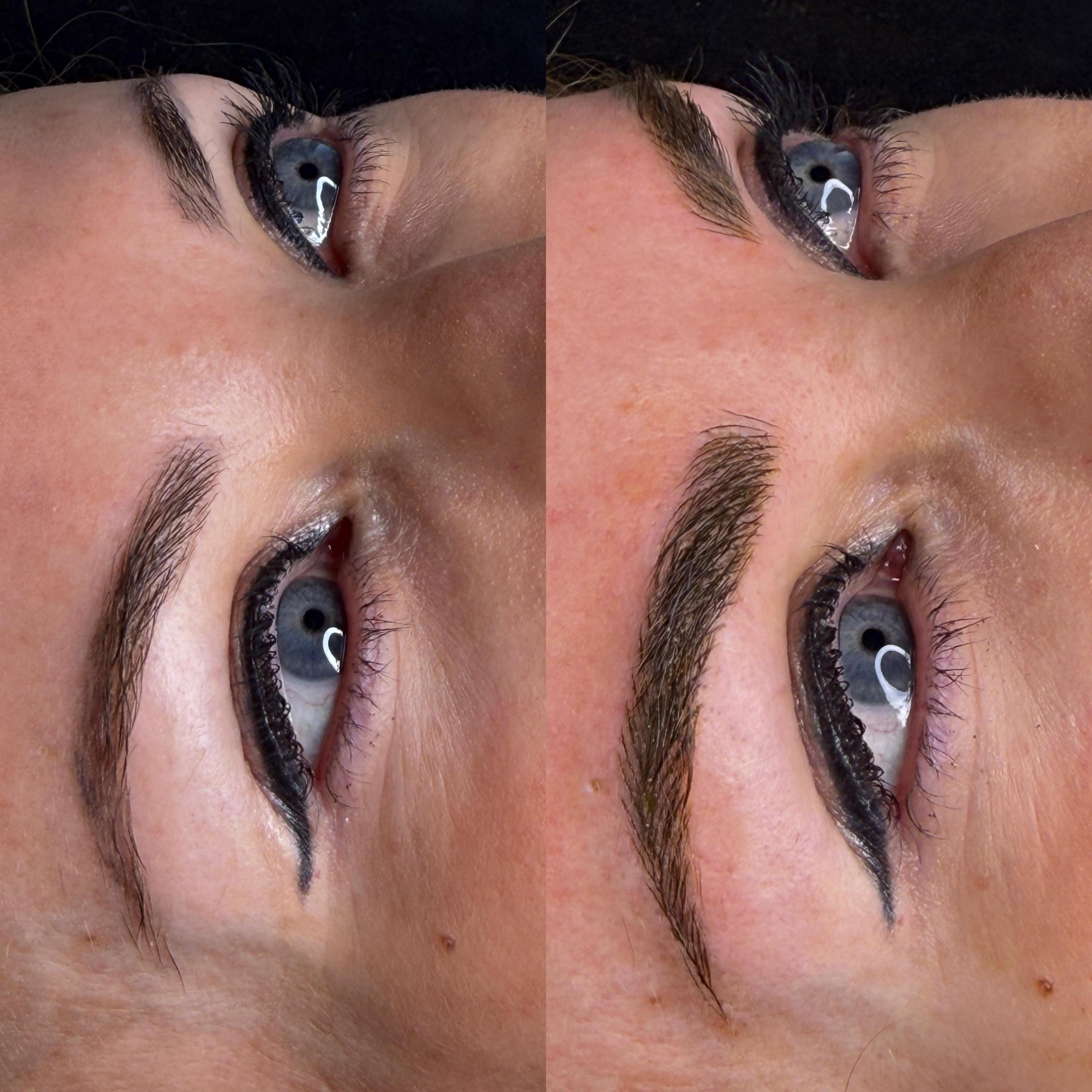 Traitement en clinique premium