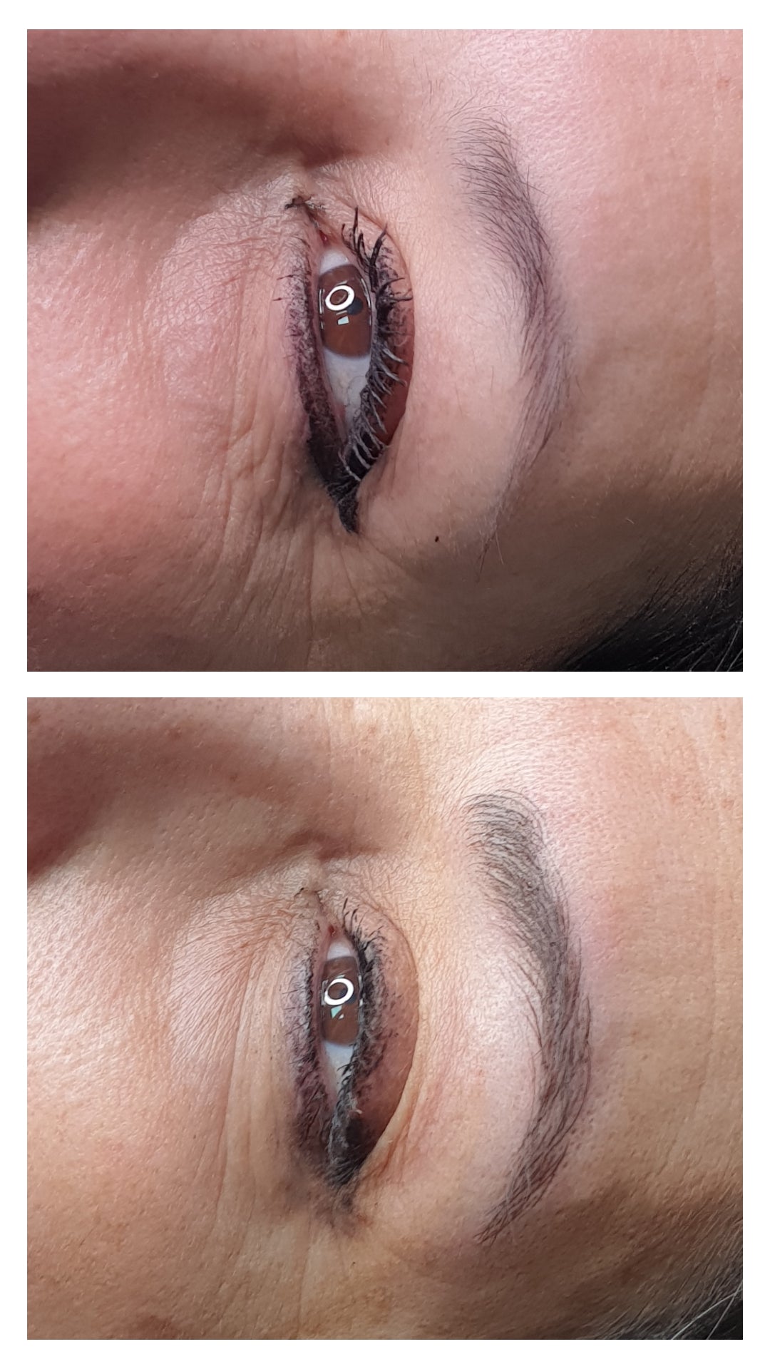 MicroBlading