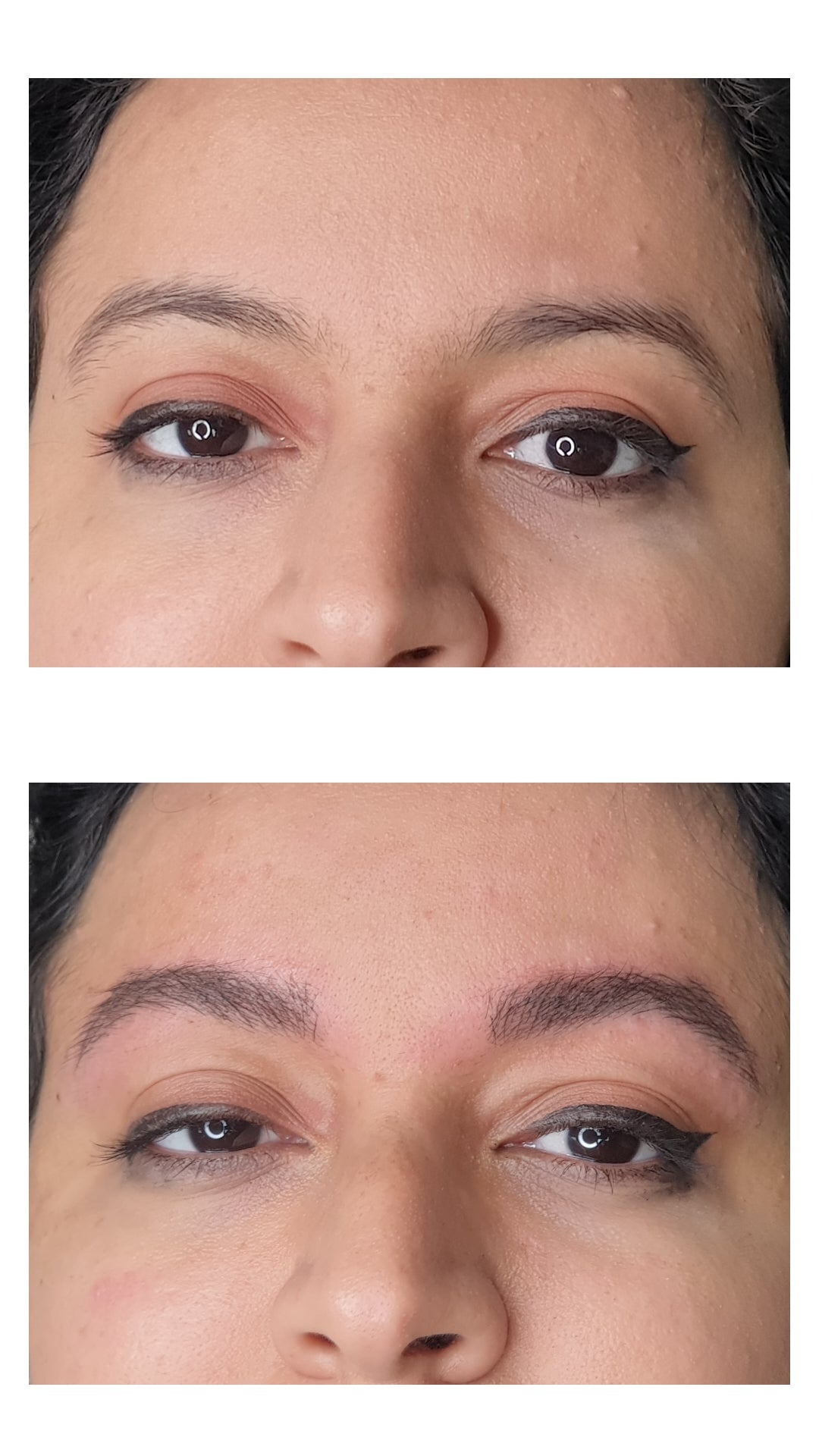 MicroBlading